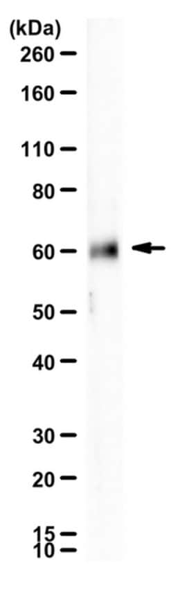 Frizzled-2, Rabbit anti-Human, Polyclonal, Millipore Sigma 100&mu;L; Unconjugated:Antibodies,